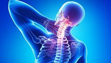Kaip pasireiškia osteochondrozė
