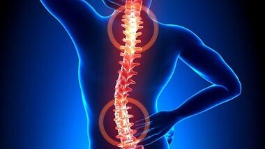 Osteochondrozės vystymosi mechanizmas
