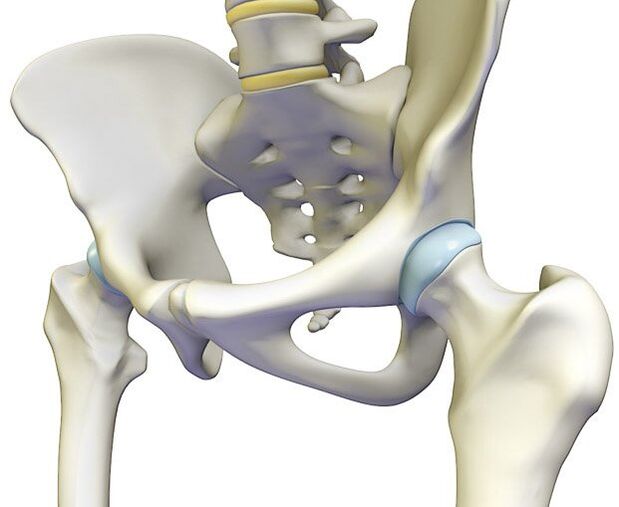 Osteochondrozė sukelia stiprų klubo sąnario skausmą