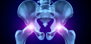 osteoartritas hip sąnario